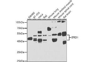 Western blot analysis of extracts of various cell lines, using IFRD1 antibody (ABIN6129279, ABIN6142215, ABIN6142217 and ABIN6223314) at 1:1000 dilution. (IFRD1 antibody  (AA 1-240))