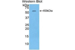 Western Blotting (WB) image for anti-H2A Histone Family, Member Y (H2AFY) (AA 109-369) antibody (ABIN1859115)
