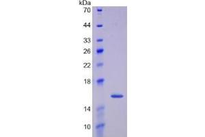 SDS-PAGE of Protein Standard from the Kit (Highly purified E. (GDF15 CLIA Kit)