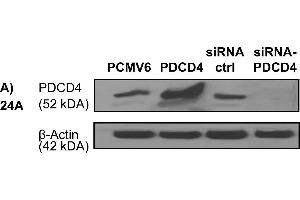Western Blotting (WB) image for anti-Programmed Cell Death 4 (PDCD4) (pSer457) antibody (ABIN129708)