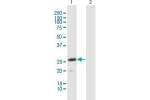 Western Blot analysis of CLEC4D expression in transfected 293T cell line by CLEC4D MaxPab polyclonal antibody.