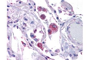 KITLG antibody was used for immunohistochemistry at a concentration of 4-8 ug/ml. (KIT Ligand antibody  (Middle Region))