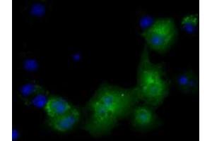 Anti-PKLR mouse monoclonal antibody (ABIN2453473) immunofluorescent staining of COS7 cells transiently transfected by pCMV6-ENTRY PKLR (RC206455). (PKLR antibody)