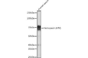 Western blot analysis of extracts of Human serum, using Hemopexin (HPX) (HPX) Rabbit mAb (ABIN7267611) at 1:5000 dilution. (Hemopexin antibody)