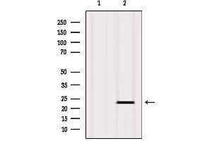 Western Blotting (WB) image for anti-Caveolin 1, Caveolae Protein, 22kDa (CAV1) (N-Term) antibody (ABIN6260512)