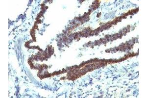 Formalin-fixed, paraffin-embedded rat lung stained with EpCAM antibody (EGP40/1110). (EpCAM antibody  (Cytoplasmic Domain))