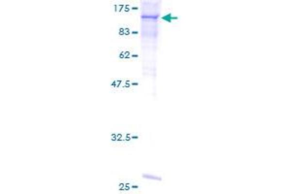 C6 Protein (AA 23-934) (GST tag)