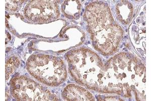 ABIN6267002 at 1/100 staining human kidney tissue sections by IHC-P. (MRRF antibody  (Internal Region))