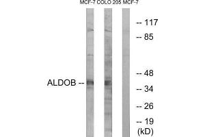 Western Blotting (WB) image for anti-Aldolase B, Fructose-Bisphosphate (ALDOB) (Internal Region) antibody (ABIN1851338) (ALDOB antibody  (Internal Region))
