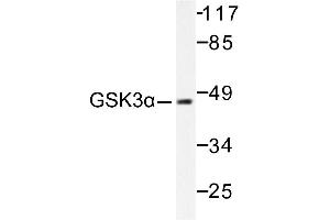 Image no. 1 for anti-Glycogen Synthase Kinase 3 alpha (GSK3a) antibody (ABIN265449)
