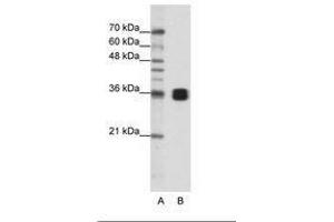 Image no. 1 for anti-Heterogeneous Nuclear Ribonucleoprotein A0 (HNRNPA0) (AA 154-203) antibody (ABIN202208) (HNRNPA0 antibody  (AA 154-203))