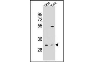 Western blot analysis of OR5L2 Antibody (N-term) in CEM,Hela cell line lysates (35ug/lane).