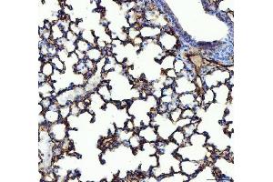 IHC analysis of ACE using anti-ACE antibody (ABIN3043777). (Angiotensin I Converting Enzyme 1 antibody  (AA 651-864))