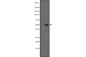 Western blot analysis of BCL2L13 expression in CEM cell line lysate ,The lane on the left is treated with the antigen-specific peptide. (BCL2L13 antibody  (Internal Region))