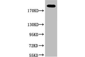 Western blot analysis of Hela, diluted at 1:2000. (Fibronectin 1 antibody)