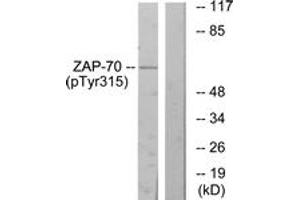 Western blot analysis of extracts from Jurkat cells treated with Ca+ 40nM 30', using ZAP-70 (Phospho-Tyr315) Antibody. (ZAP70 antibody  (pTyr315))