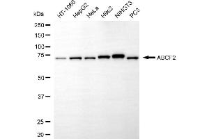 Western blotting analysis using ABCF2 antibody (ABIN7797689).