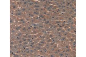 Used in DAB staining on fromalin fixed paraffin- embedded Kidney tissue (Complement C4 antibody  (AA 126-366))