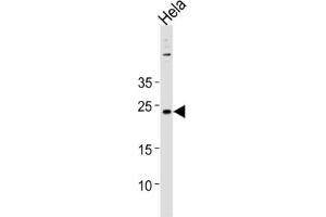 Western Blotting (WB) image for anti-Cappuccino Homolog (CNO) antibody (ABIN3004642) (BLOC1S4 antibody)