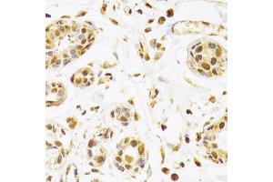 Immunohistochemistry of paraffin-embedded human breast using SEPHS1 Antibody (ABIN5973853) at dilution of 1/100 (40x lens).