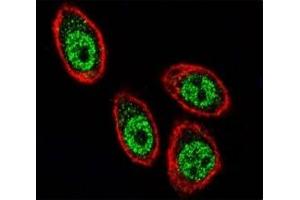 Confocal immunofluorescent analysis of PHB antibody with HeLa cells followed by Alexa Fluor 488-conjugated goat anti-rabbit lgG (green).