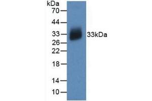 Detection of Recombinant IL12A, Human using Monoclonal Antibody to Interleukin 12A (IL12A) (IL12A antibody  (AA 23-219))