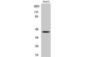 Western Blotting (WB) image for anti-Sterol O-Acyltransferase 1 (SOAT1) (Internal Region) antibody (ABIN3183138) (SOAT1 antibody  (Internal Region))