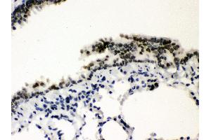 Immunohistochemistry (Paraffin-embedded Sections) (IHC (p)) image for anti-Sp3 Transcription Factor (Sp3) (AA 569-599), (C-Term) antibody (ABIN3043350) (Sp3 antibody  (C-Term))