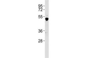 Western blot testing of GATA2 antibody at 1:2000 dilution + K562 lysate. (GATA2 antibody  (C-Term))