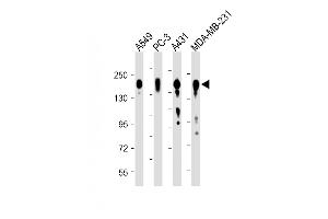 All lanes : Anti-EGFR Antibody (C-term) at 1:8000 dilution Lane 1: A549 whole cell lysate Lane 2: PC-3 whole cell lysate Lane 3: A431 whole cell lysate Lane 4: MDA-MB-231 whole cell lysate Lysates/proteins at 20 μg per lane. (EGFR antibody  (C-Term))