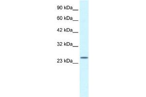 WB Suggested Anti-ZA20D3 Antibody Titration:  2. (ZFAND6 antibody  (Middle Region))