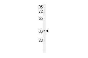 IGFBP3- (ABIN391976 and ABIN2841769) western blot analysis in mouse stomach tissue lysates (15 μg/lane). (IGFBP3 antibody  (AA 162-189))