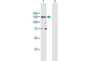Western Blot analysis of DNMT3A expression in transfected 293T cell line by DNMT3A MaxPab polyclonal antibody. (DNMT3A antibody  (AA 1-912))