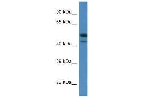 Western Blot showing Sbk1 antibody used at a concentration of 1. (SBK1 antibody  (C-Term))