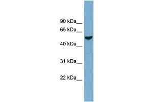 WB Suggested Anti-FAM83E  Antibody Titration: 0. (FAM83E antibody  (Middle Region))