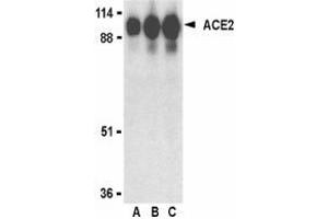 Western blot analysis of ACE2 in human kidney lysate with AP30006PU-N ACE2 antibody at (A) 0. (ACE2 antibody  (Intermediate Domain 1))
