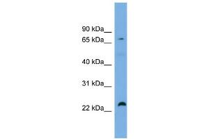 WB Suggested Anti-SPG20  Antibody Titration: 0.