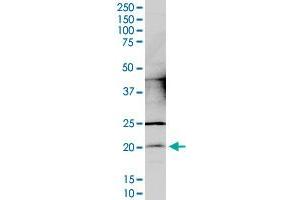 CCDC12 monoclonal antibody (M05), clone 7B1. (CCDC12 antibody  (AA 1-166))