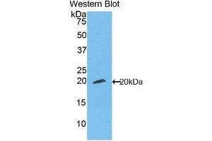 Figure. (ENPP1 antibody  (Biotin))