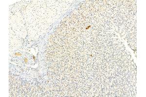 ABIN6263177 and ABIN6266588 at 1/100 staining Rat stomach tissue by IHC-P. (MDM2 antibody)