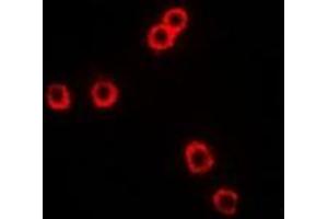 Immunofluorescent analysis of CD281 staining in Hela cells. (TLR1 antibody)