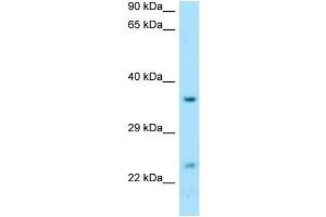 WB Suggested Anti-DTD1 Antibody Titration: 1. (DTD1 antibody  (C-Term))