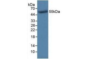 Detection of Recombinant TK1, Human using Monoclonal Antibody to Thymidine Kinase 1, Soluble (TK1)