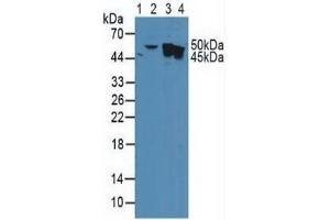 Rabbit Detection antibody from the kit in WB with Positive Control: Sample Lane1: Human Serum; Lane2: Human MCF-7 Cells; Lane3: Human A431 Cells; Lane4: Human HepG2 Cells. (CYFRA21.1 CLIA Kit)