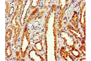 Immunohistochemistry of paraffin-embedded human kidney tissue using ABIN7160642 at dilution of 1:100 (MTMR14 antibody  (AA 1-280))