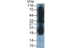 Detection of IFNg in Cavia Testis lysate using Polyclonal Antibody to Interferon Gamma (IFNg) (Interferon gamma antibody  (AA 24-166))