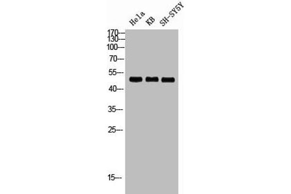 RRS1 anticorps  (Internal Region)