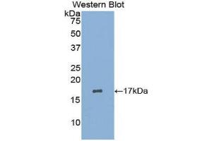 Western Blotting (WB) image for anti-Leukemia Inhibitory Factor Receptor alpha (LIFR) (AA 45-184) antibody (ABIN1173141) (LIFR antibody  (AA 45-184))