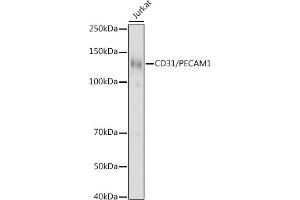 Western blot analysis of extracts of Jurkat cells, using CD31/PEC antibody (ABIN3022923, ABIN3022924, ABIN3022925 and ABIN6219299) at 1:1000 dilution. (CD31 antibody  (AA 130-230))