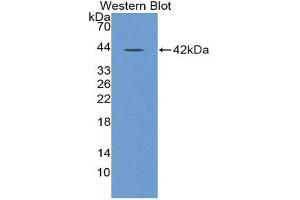 Western Blotting (WB) image for anti-Nuclear Factor kappa B (NFkB) (AA 805-892) antibody (ABIN1980478)
